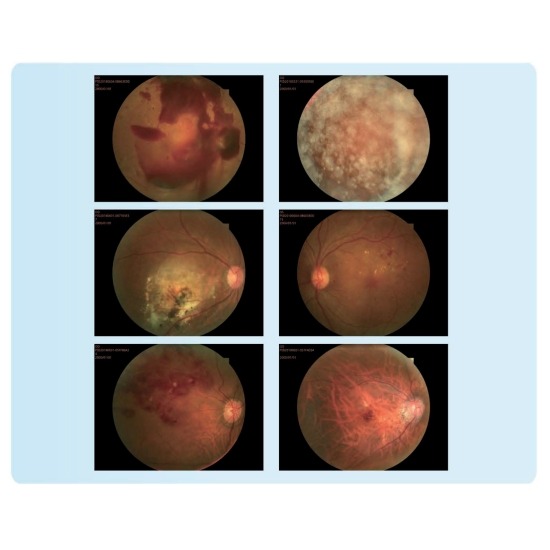 Quality HD-imaging 
