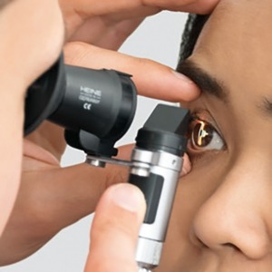 HSL 150 hand-held slit lamp - by Opthalmo