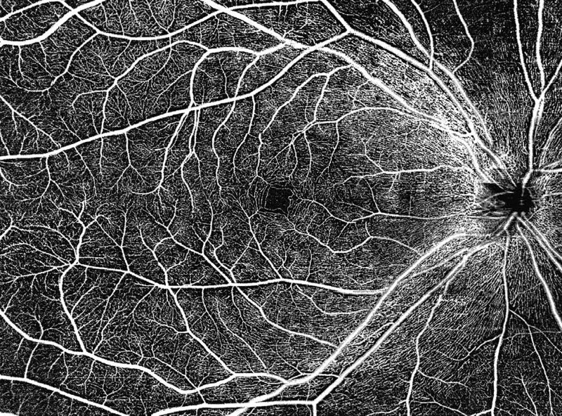 HD OCT IMAGING SYSTEM AT 80,000 A-SCANS/S
